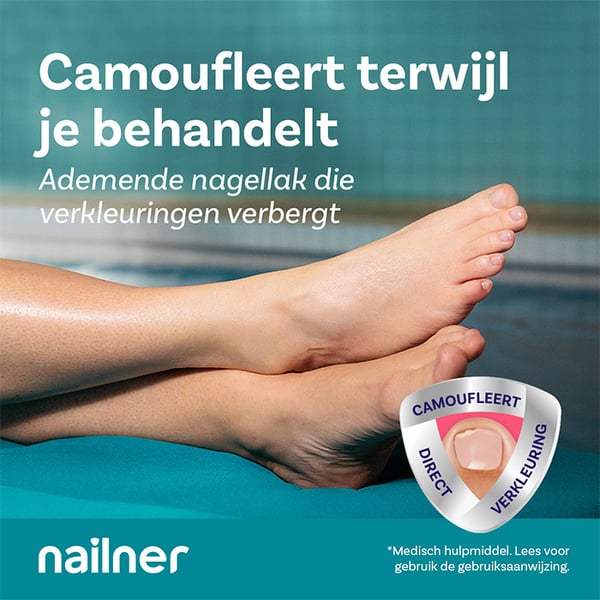 Behandel-&-Camoufleer-lev4