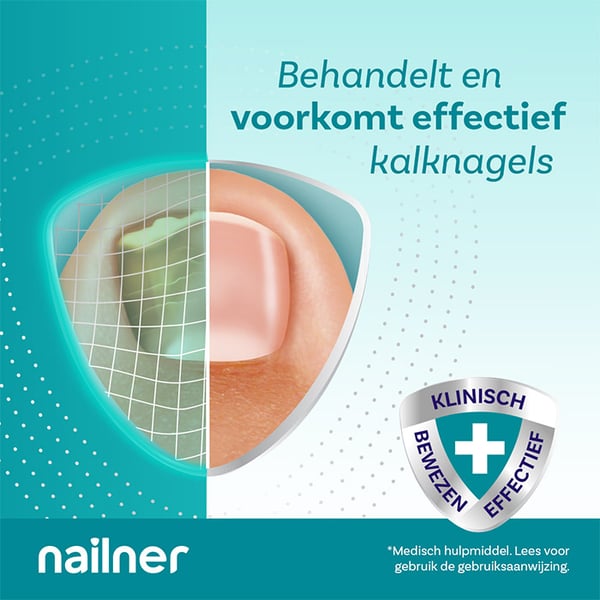 Behandel-&-Camoufleer-lev5